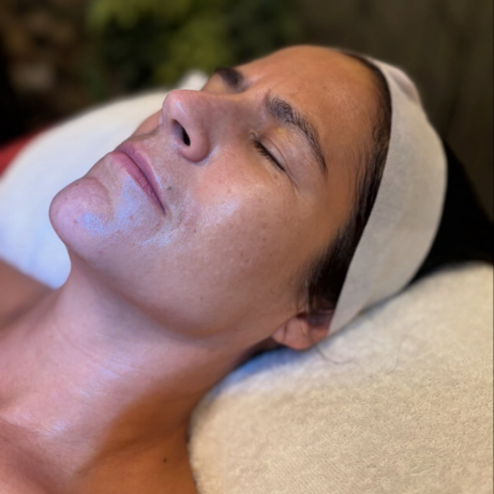 Teen Acne Facial at Simple Skin With Madison in Omaha, NE