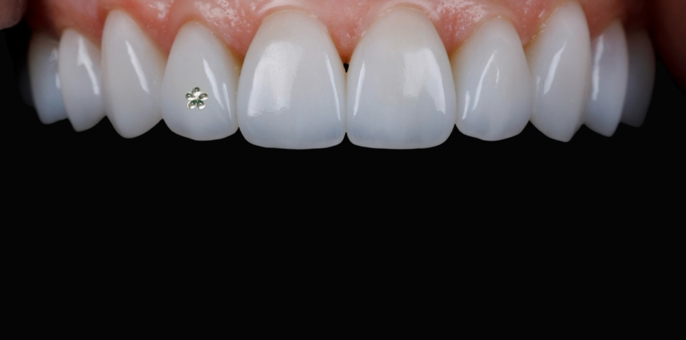 Micro Flower Crystal