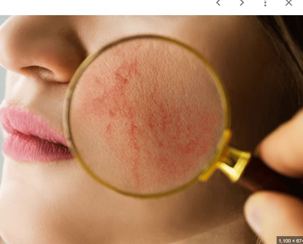 Sensitive Skin Facial at Facial Sensations in Lewisville, TX