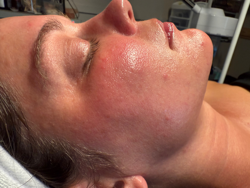Illumé Clear Facial at GlowHaus Collective By Monét in Camden, AR