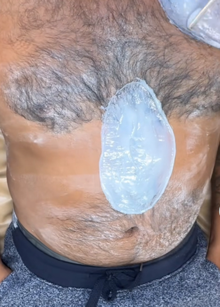 Chest Wax