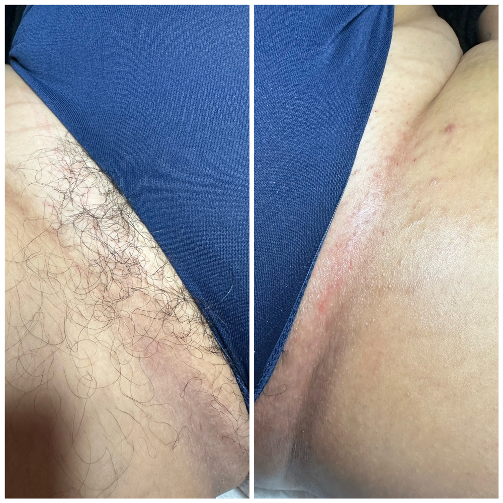 Bikini Wax