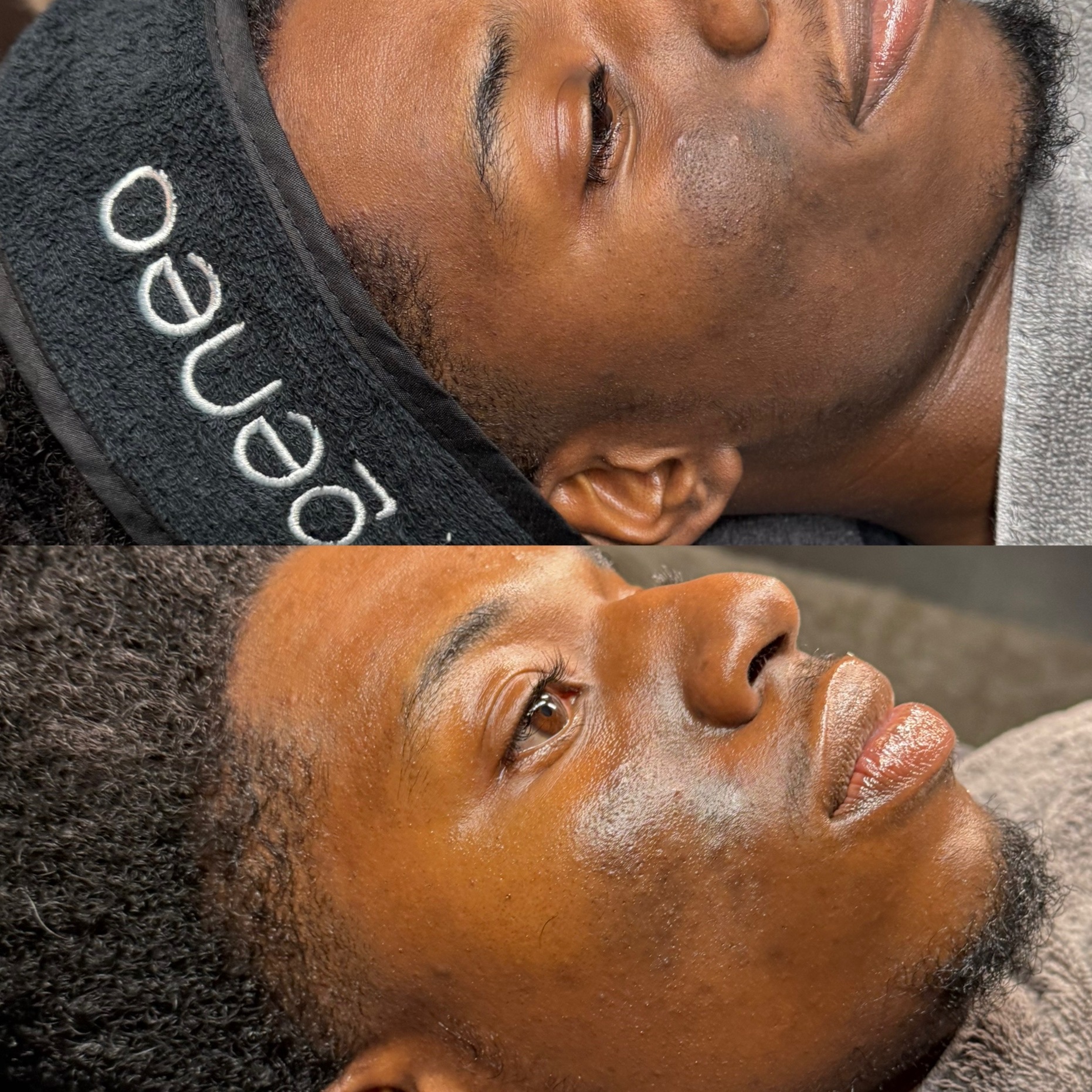 HYPERPIGMENTATION BOOTCAMP at Beautiquè by Blanche in Charlotte, NC