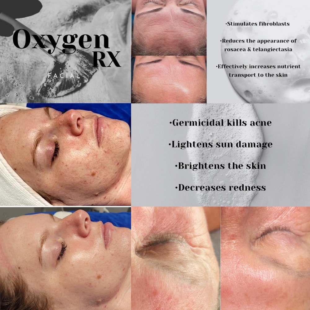 Oxygen RX Facial