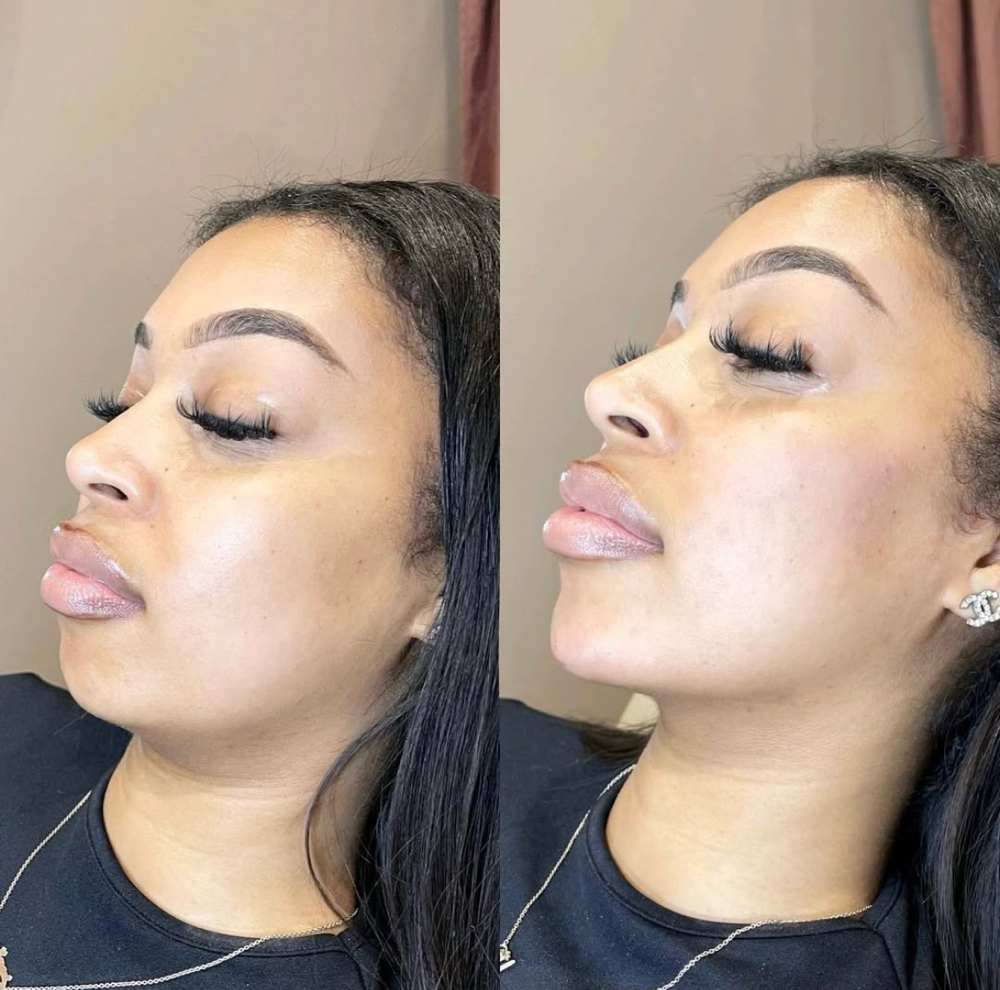 Facial Balancing Consultation