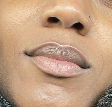 Lip