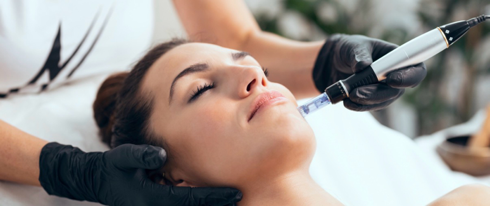 Collagen induction therapy at Triple B in La Porte, TX