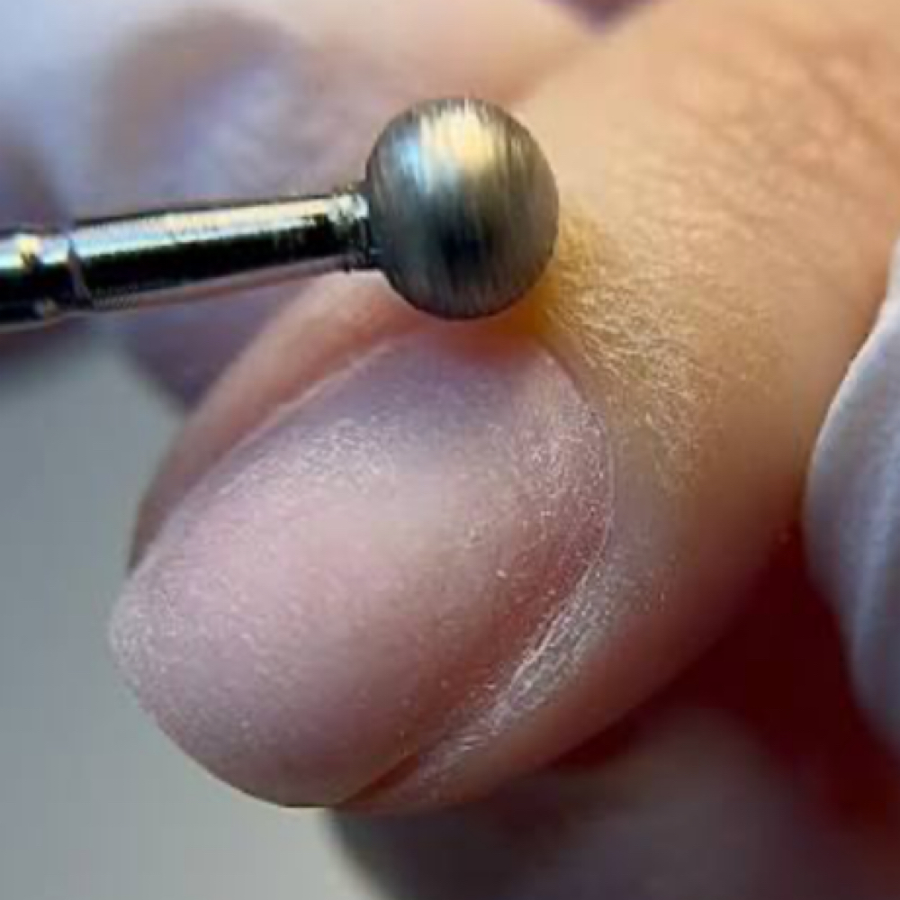 Dry Skin Exfoliation at Gloss Pond in Portland, OR