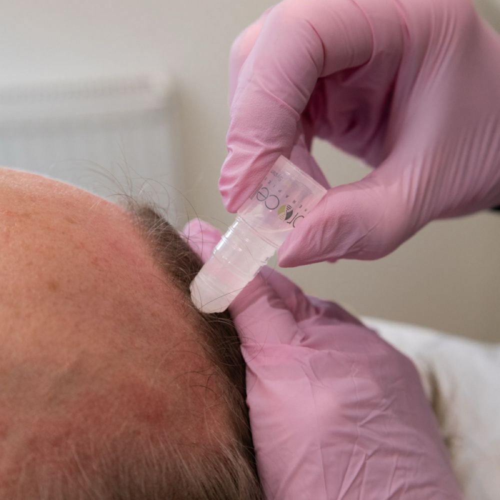 Procell Hair Rejuvenation Package-6 at Alma Massage & Wellness in Wilmington, NC