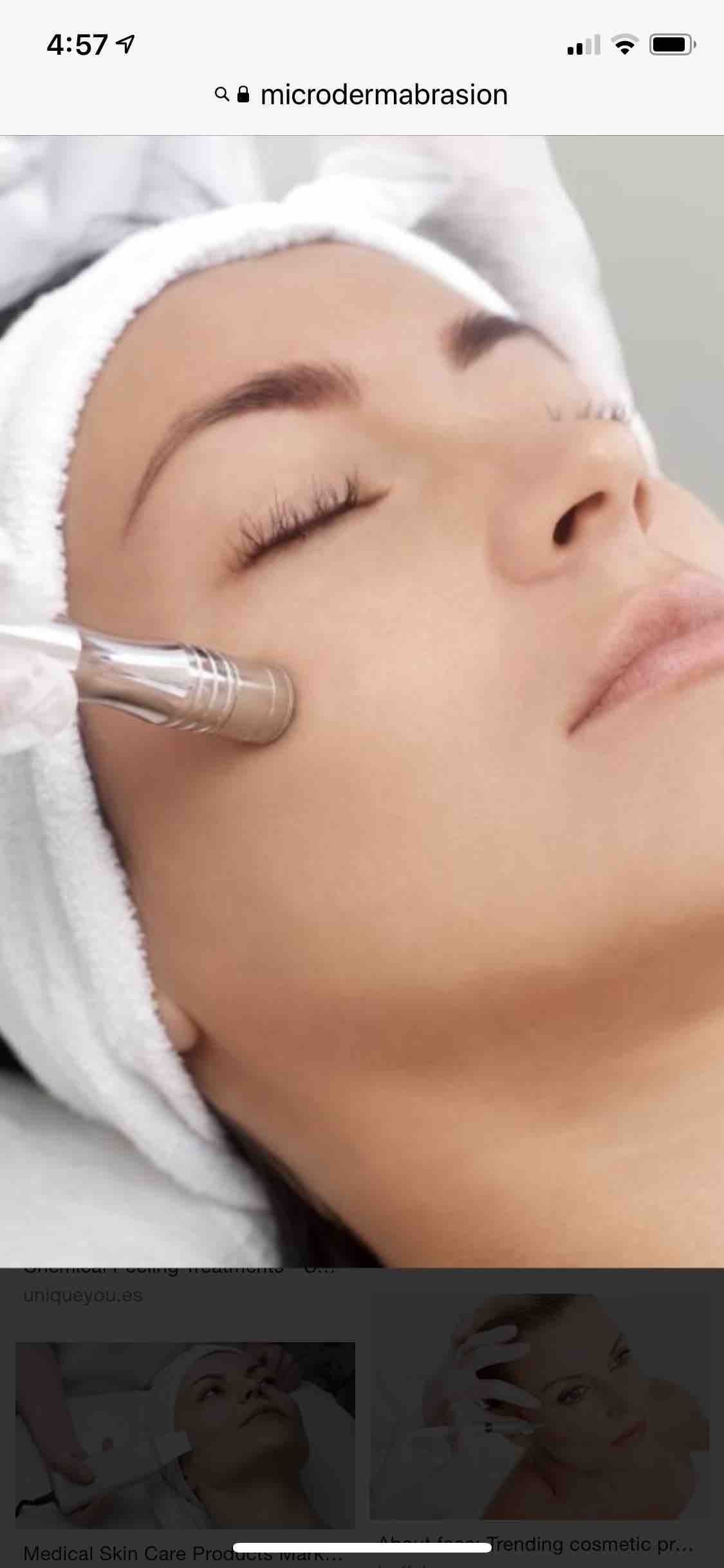 Microdermabrasion