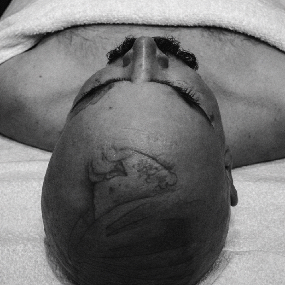 The Bro Code Treatment  |  La Verne at AJ Skin Studio in La Verne, CA