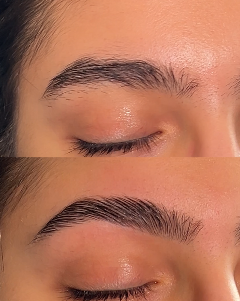 Brow
