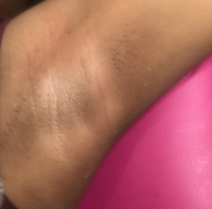 Woman Underarms