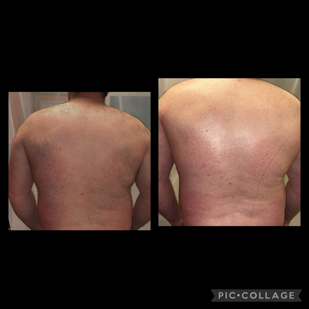 Back Full