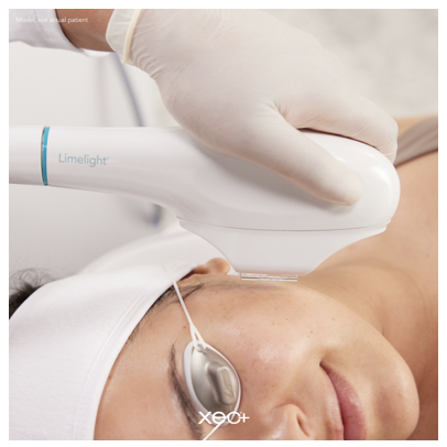 IPL - Face|Neck|Chest
