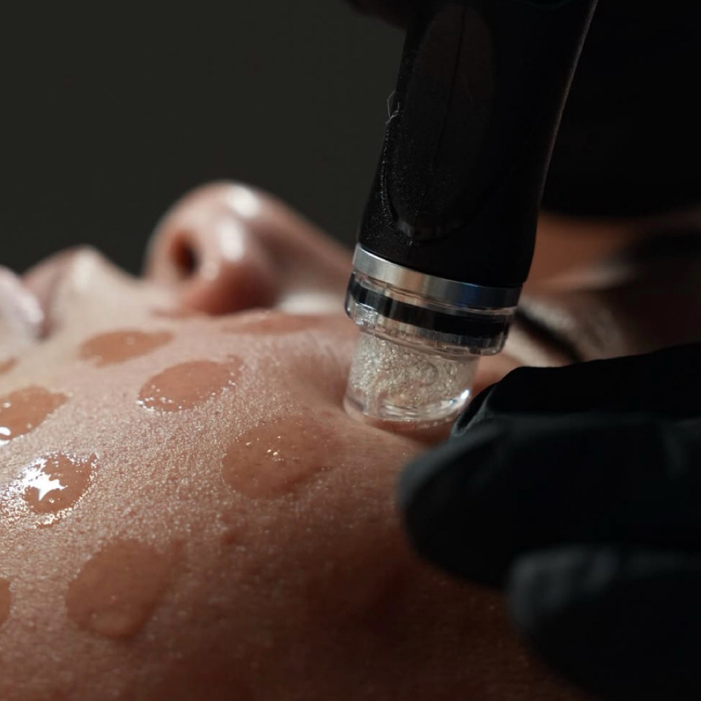 Hydrofacial at Savannah Aesthetics in Danville, KY