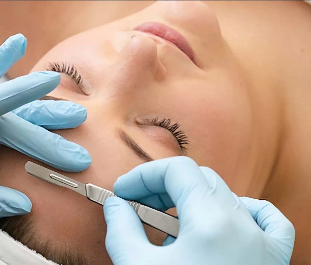 Dermaplaning