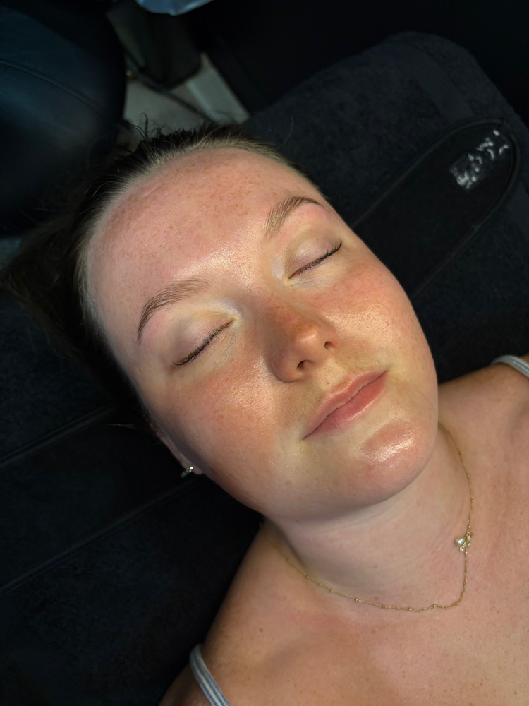 Dermaplane Facial