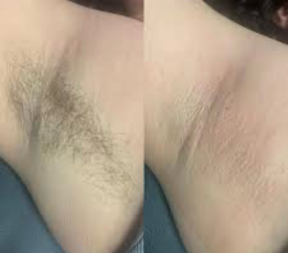 Underarm Wax