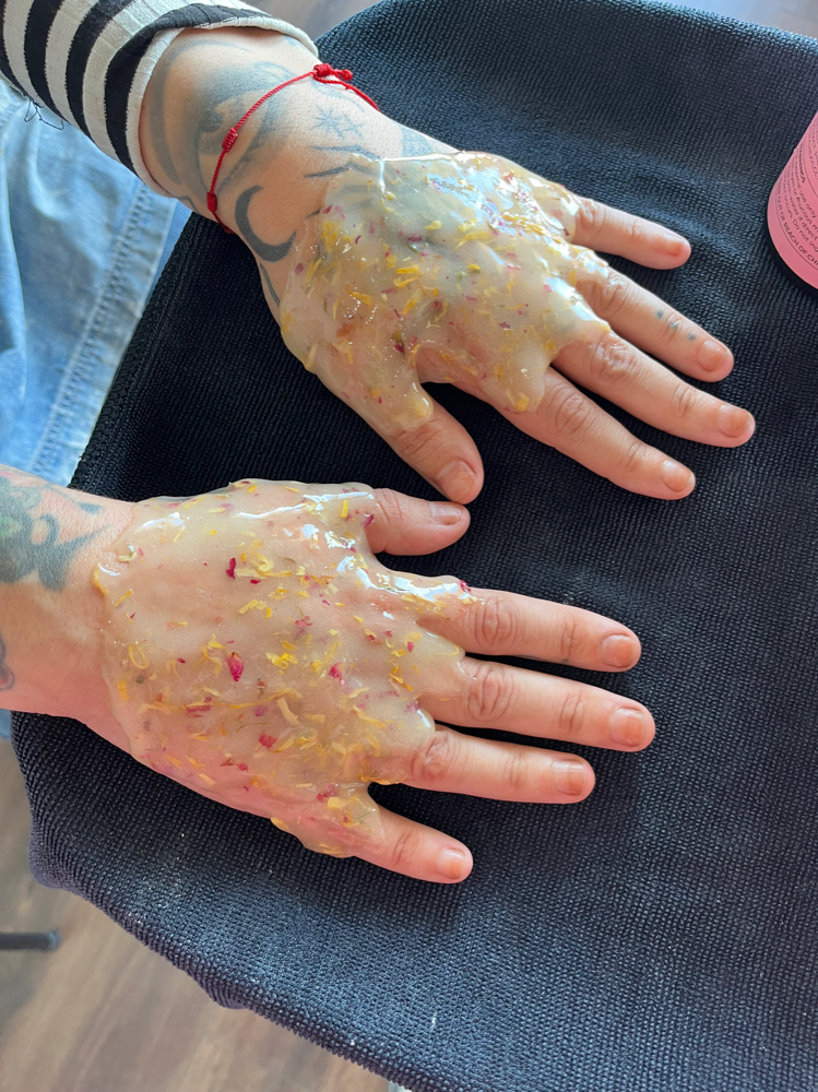 Hand Rejuvenation Treatment