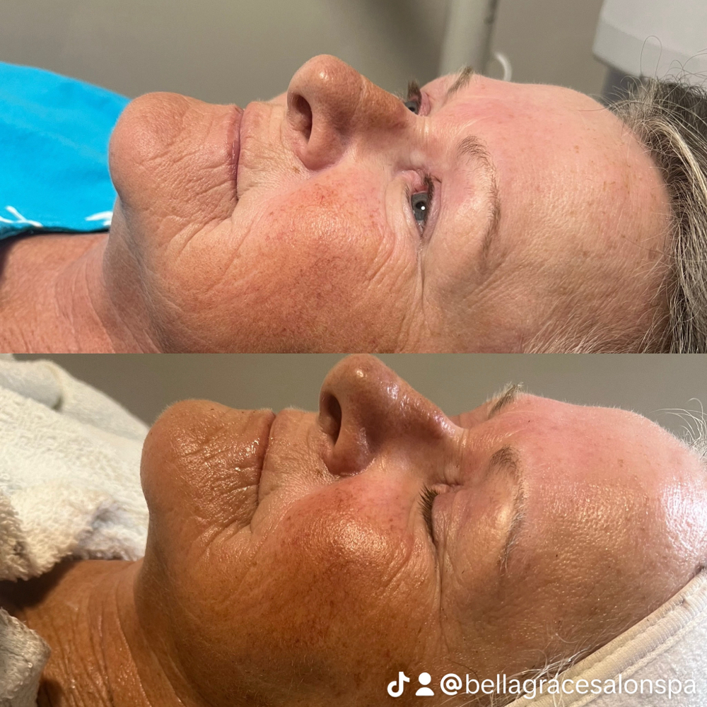 Firming Peptide Anti Aging Facial