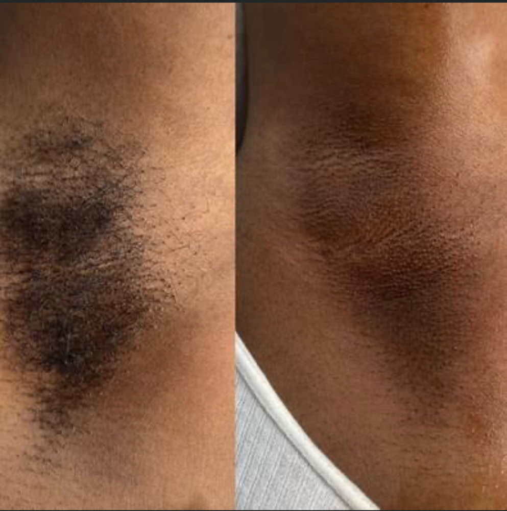 Underarm Wax