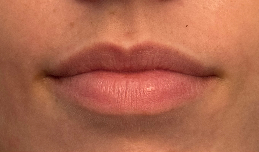 Lip