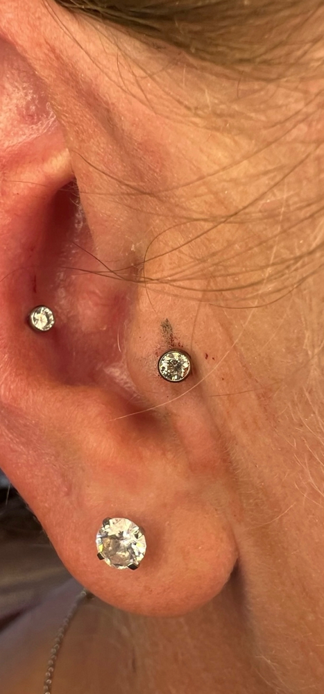 Tragus