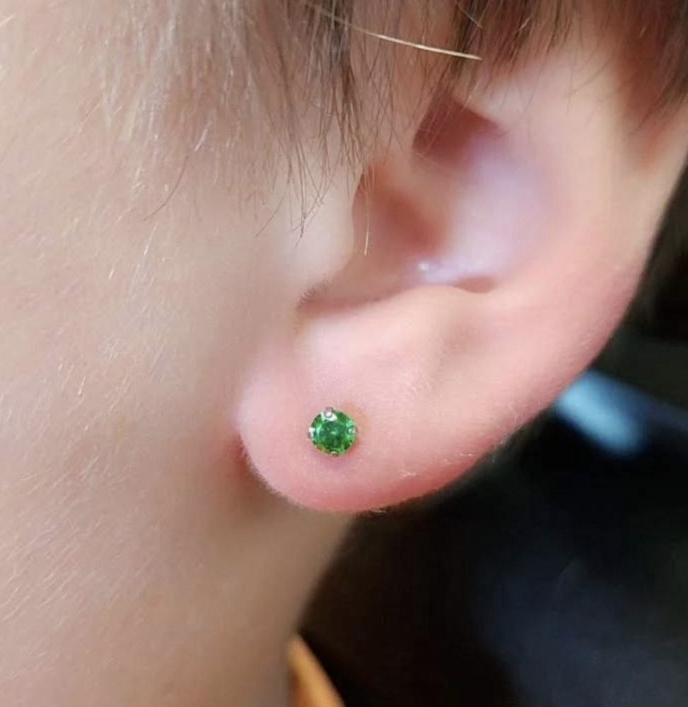 Single Lobe Over Age 10
