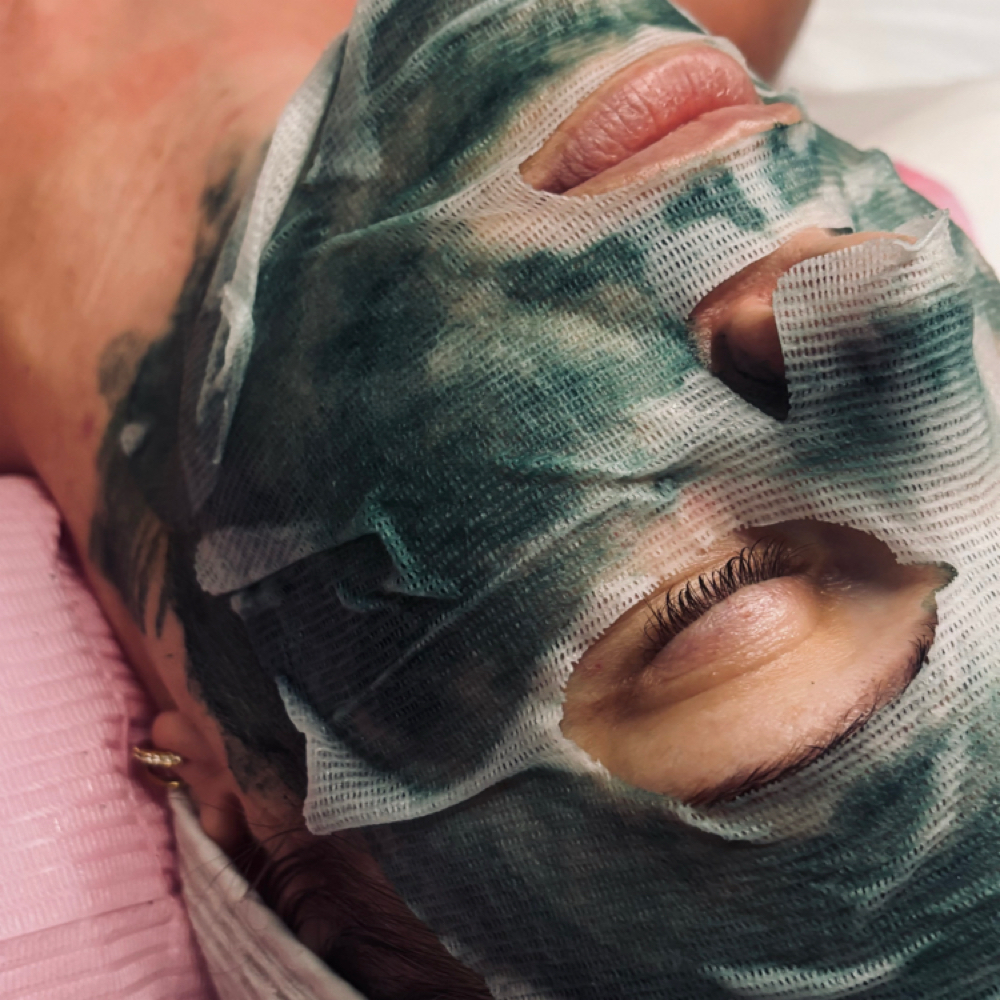 Liquid Microneedling at Radiant Glo Aesthetics in Ottawa, KS