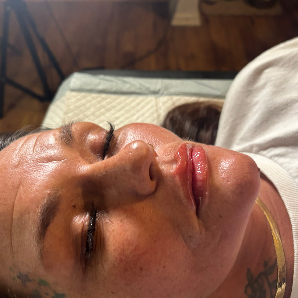 .05ML Micro Needle at Spoiled Brat Aesthetics in Houston, TX
