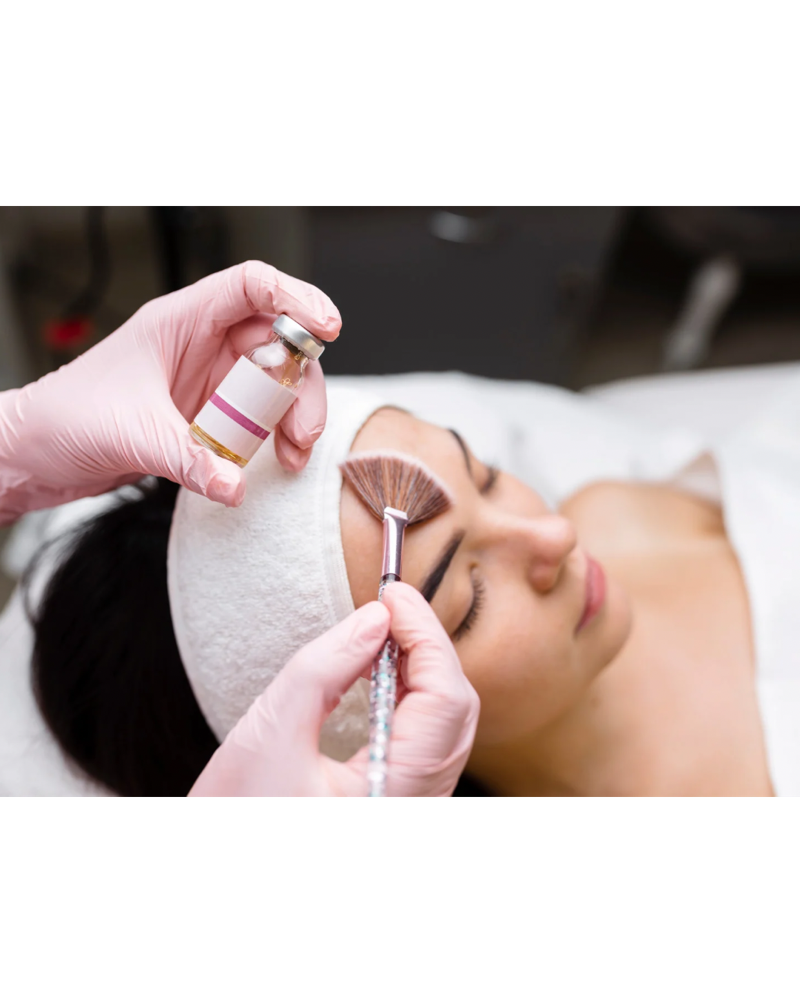 Chemical Peel - VI PEEL