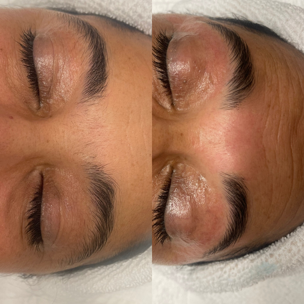 Eyebrow Waxing