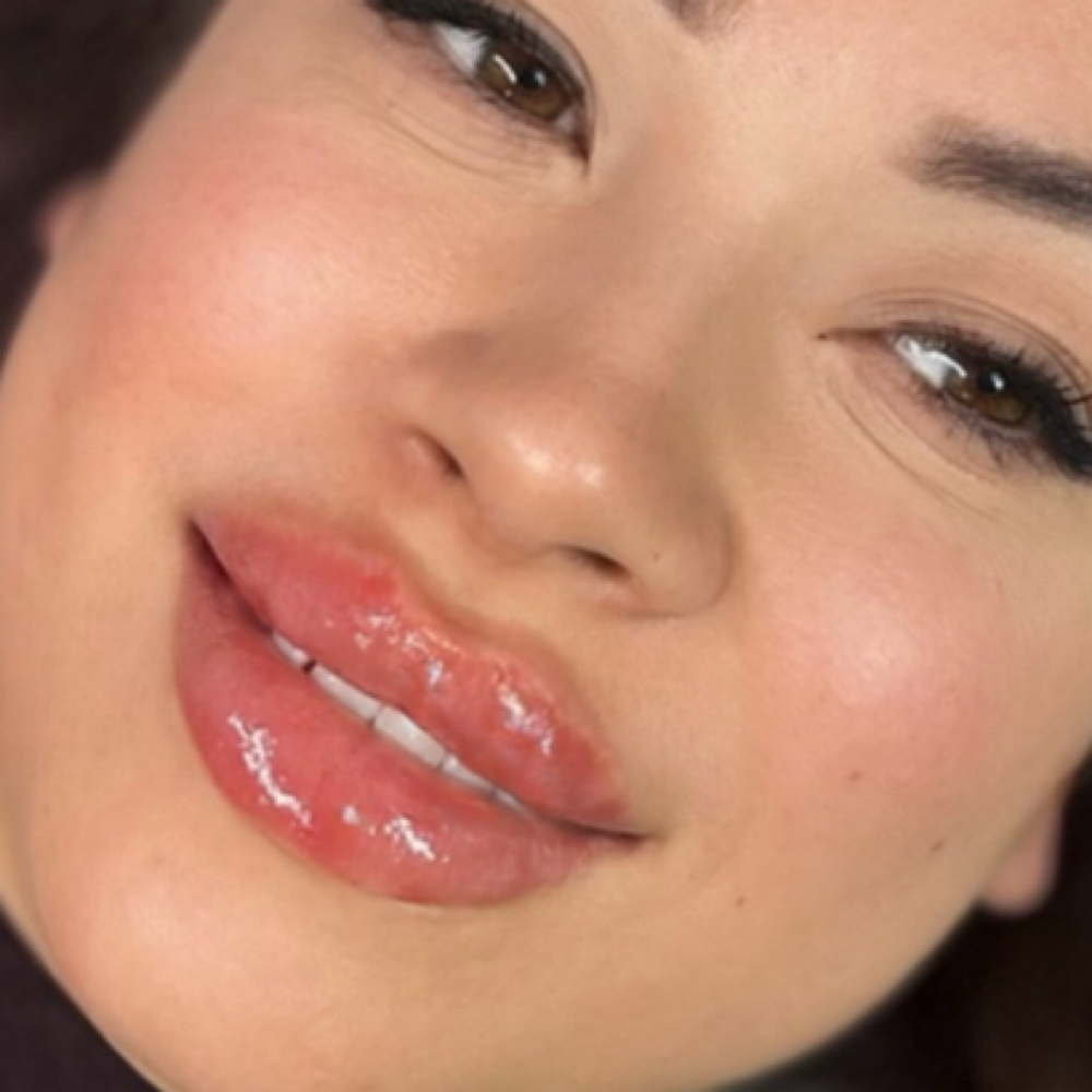 1ML FULL SYRINGE •LIPS• at Glam X Sam MedBeauty in Andrews, TX