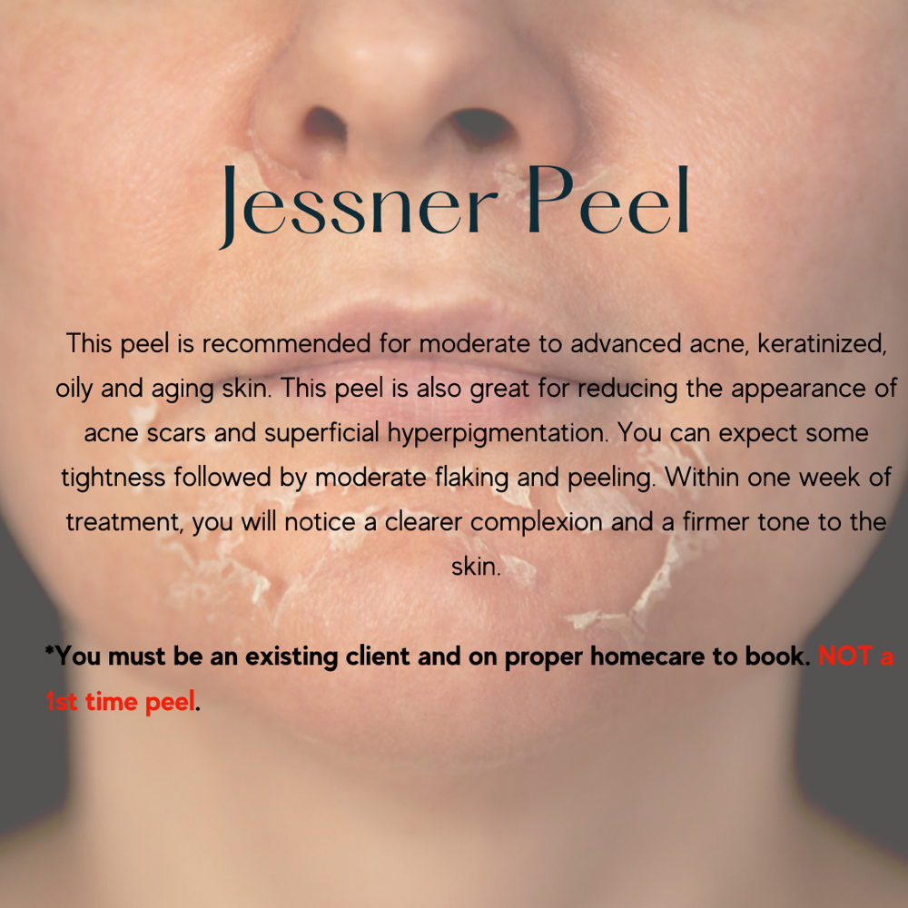 Jessner Peel