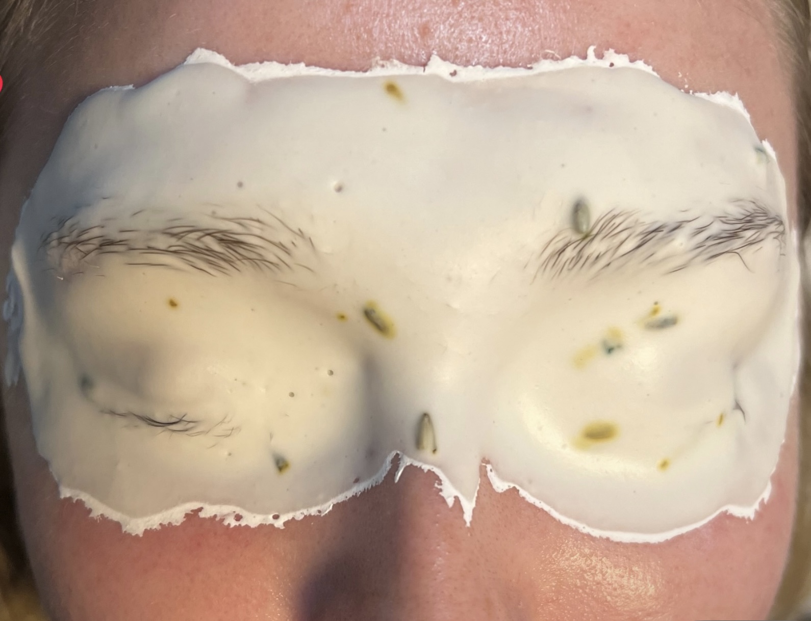 Eye Dew Care Treatment