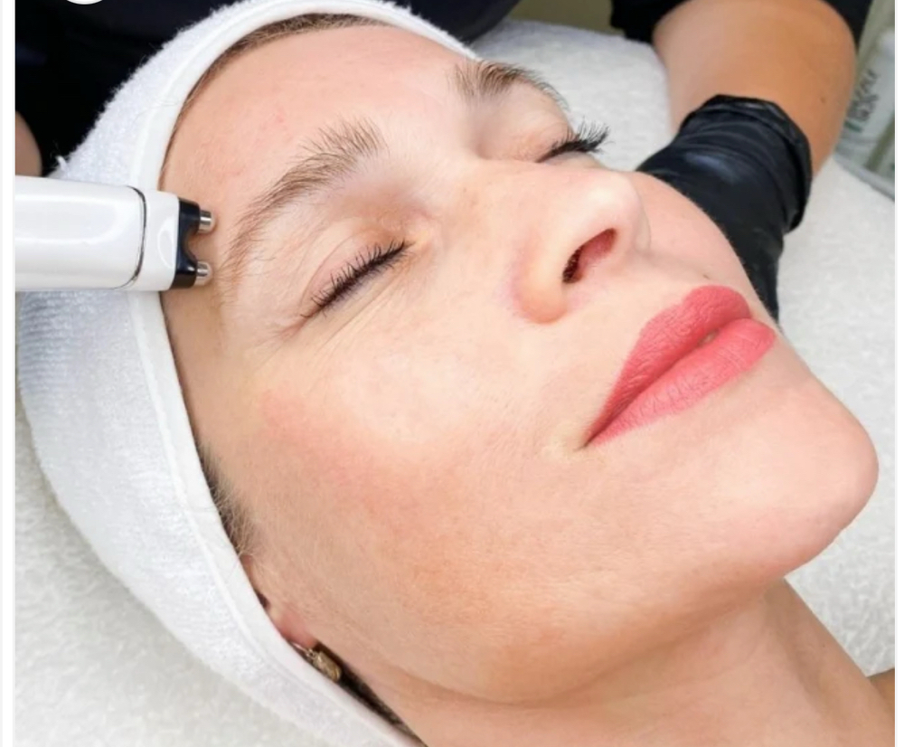 Skin Tightening facial