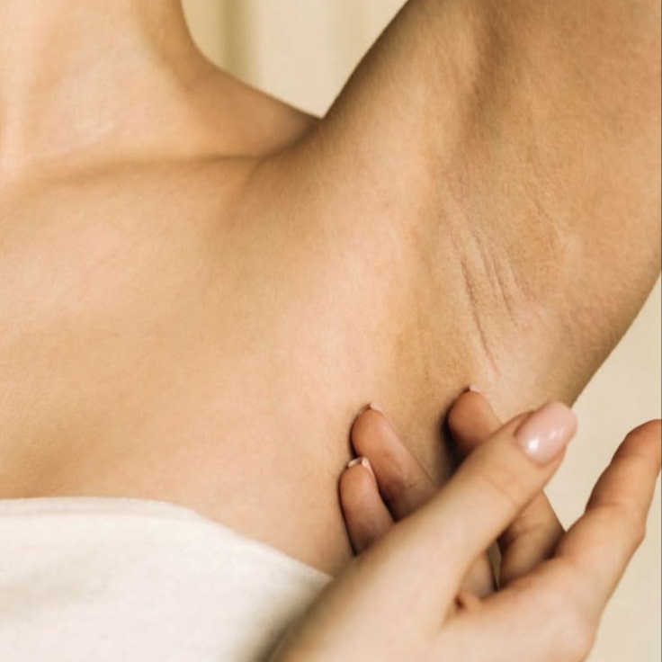 Intimate Skin Brightening at REVIVD Aesthetics & Wellness in Mission, TX