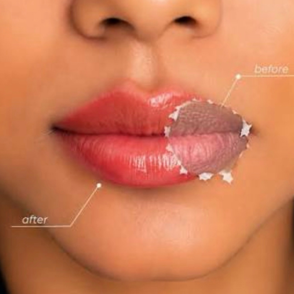 DARK LIP NEUTRALIZATION at Daisy Nano Brows in Southlake, TX