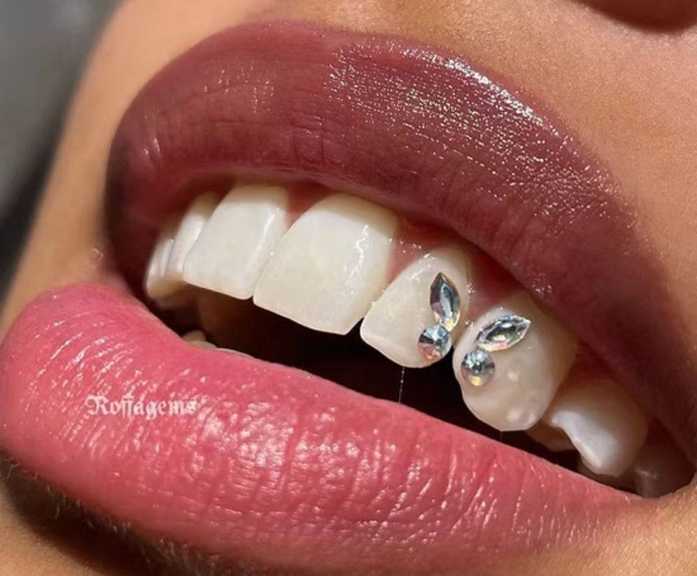 Tooth Gems