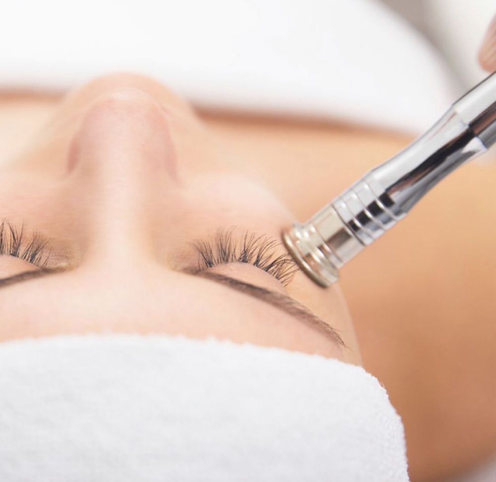 Platinum Microdermabrasion Facial