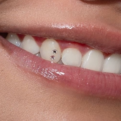 Tooth Gems - Double at Rise Beauty Studio in Forest Grove, OR