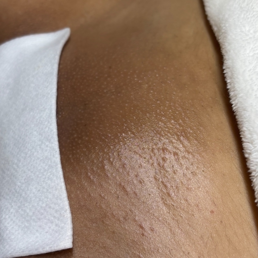 Bestie Brazilian Wax Bundle at Jennssesthetics in College Park, MD