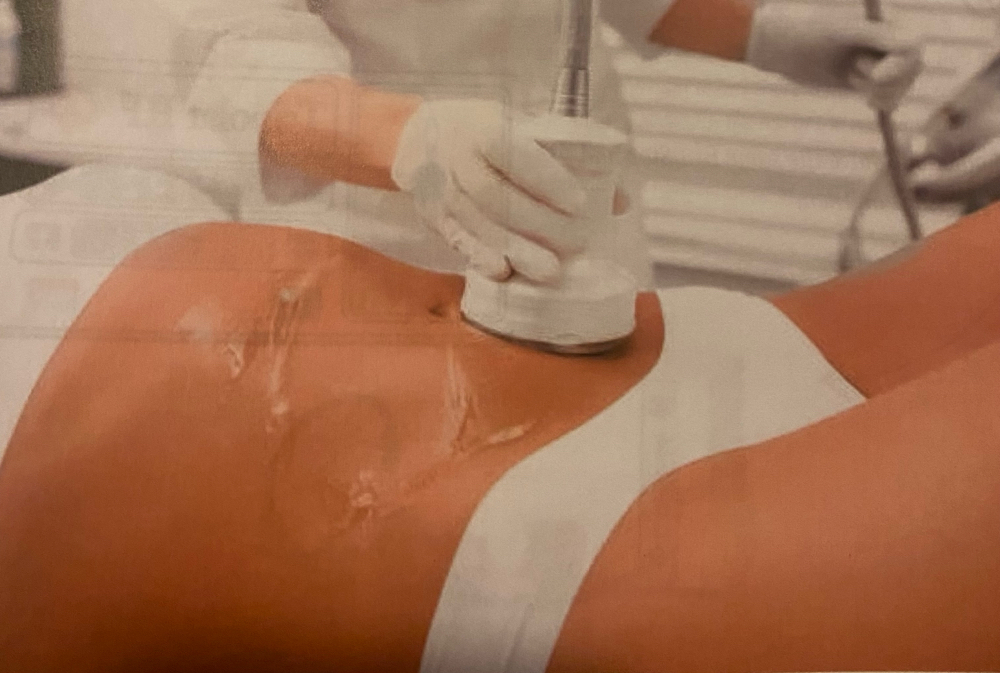 Cavitation Body Sculpting