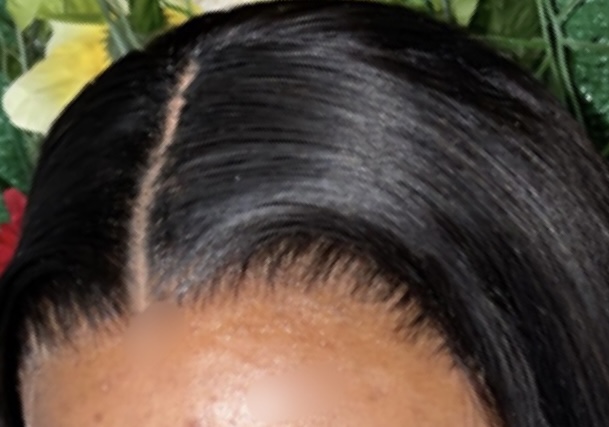Lace Frontal Sew-in