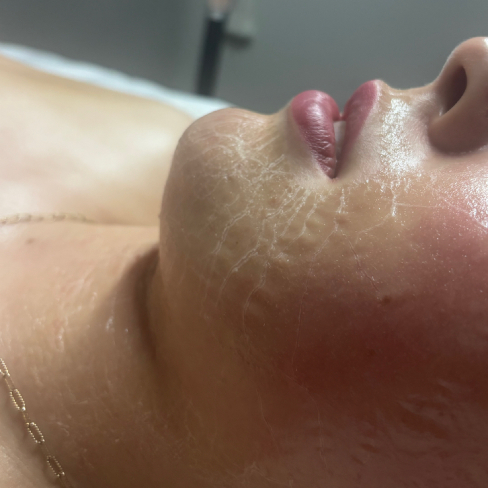No Tox Botox-Peptide Firming Facial at Radiant Glo Aesthetics in Ottawa, KS