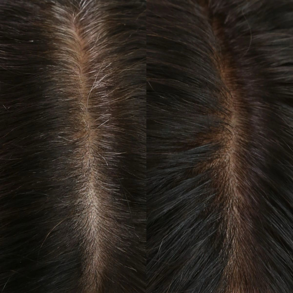 Root touch up