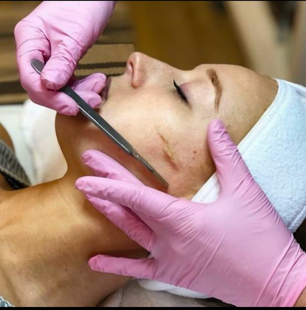 Dermaplaning