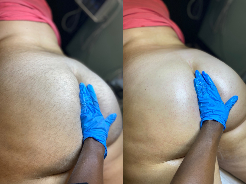 Butt
