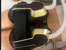 EMS Muscle Toning